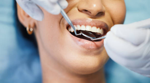 Best Dentist for Tooth Abscess  in Belle, WV