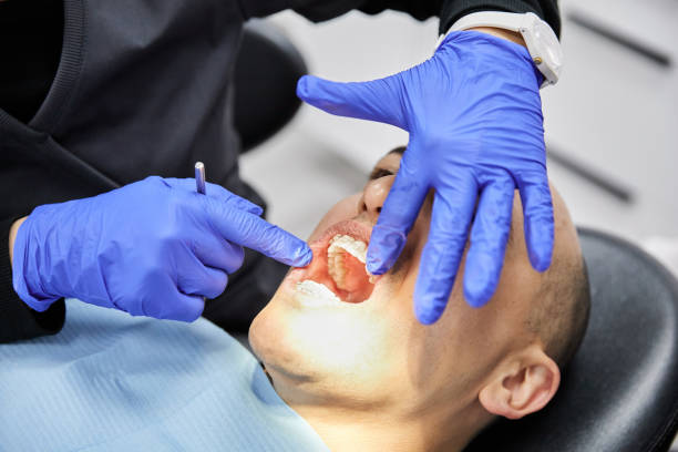 Best Knocked-Out Tooth Emergency  in Belle, WV